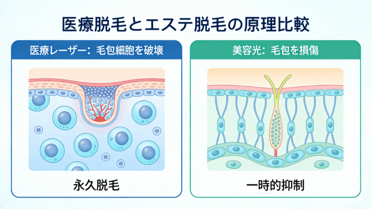 医療脱毛とエステ脱毛の決定的な違いとは？失敗しないための基礎知識